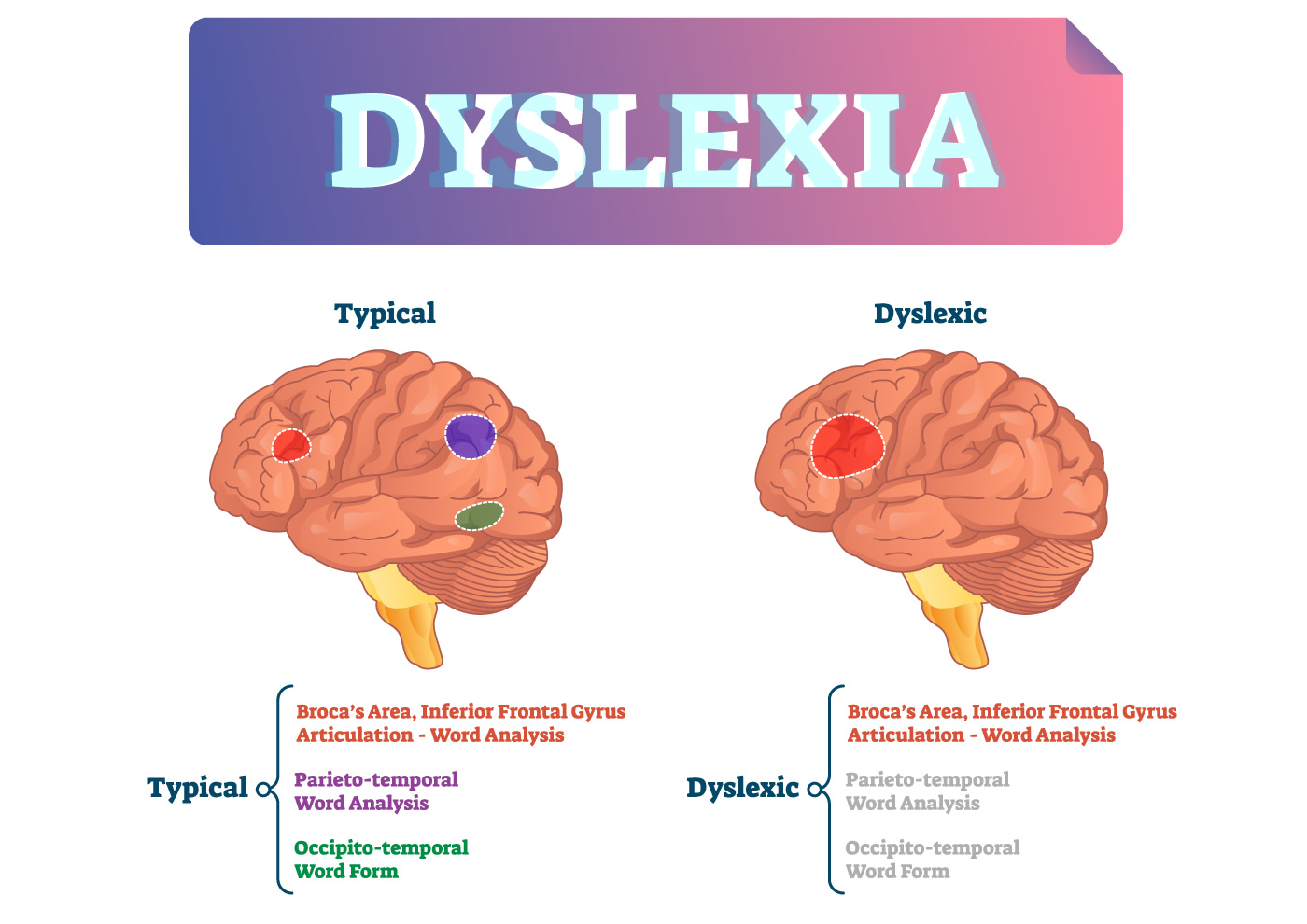 What is Dyslexia Literacy Matters